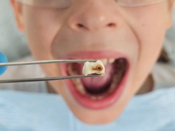 Emergency Dentist for Kids in NC